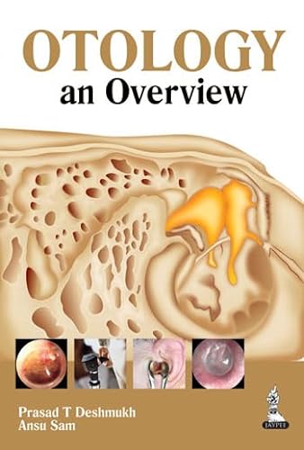Stock image for Otology: an Overview (Paperback) for sale by Grand Eagle Retail