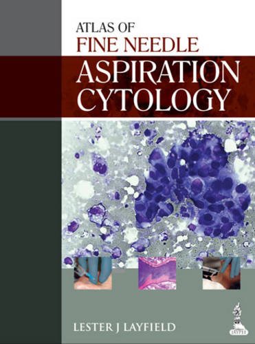 Beispielbild fr Atlas of Fine Needle Aspiration Cytology. zum Verkauf von Research Ink