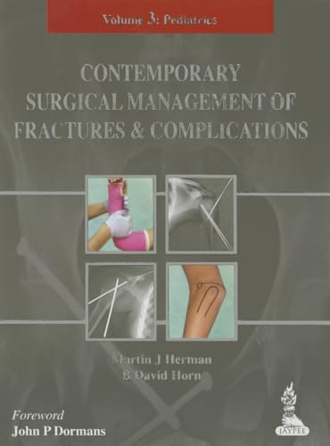 Beispielbild fr Contemporary Surgical Management of Fractures and Complications. Volume 3:Pediatrics zum Verkauf von Research Ink