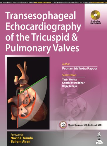 Stock image for Transesophageal Echocardiography of the Tricuspid and Pulmonary Valves for sale by Learnearly Books