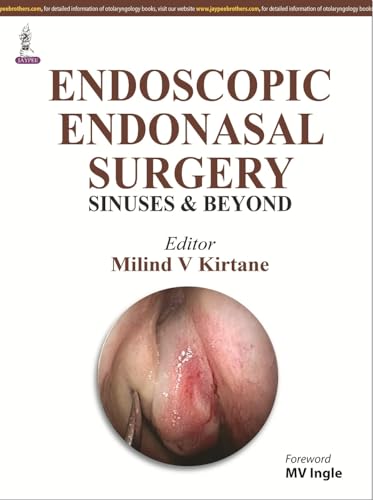 9789351521501: Endoscopic Endonasal Surgery: Sinuses and Beyond