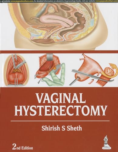 9789351521792: Vaginal Hysterectomy