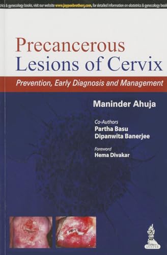 Beispielbild fr Precancerous Lesions of Cervix: Prevention, Early Diagnosis and Management zum Verkauf von Ria Christie Collections