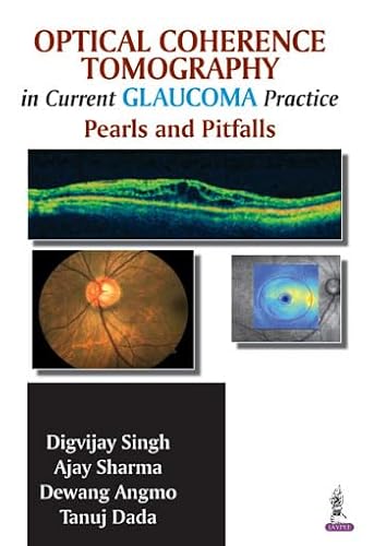 Stock image for OPTICAL COHERENCE TOMOGRAPHY IN CURRENT GLAUCOMA PRACTICE : PEARLS AND PITFALLS for sale by Basi6 International