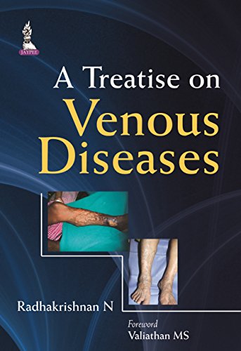 Beispielbild fr A Treatise on Venemous Diseases. zum Verkauf von Research Ink