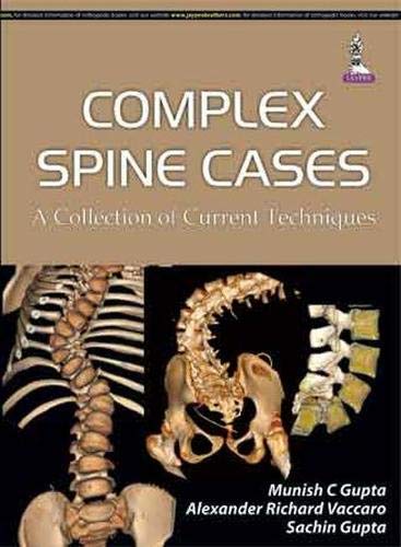 9789351523864: Complex Spine Cases: A Collection of Current Techniques