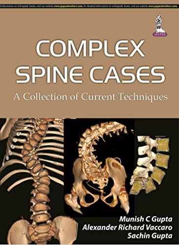 Stock image for Complex Spine Cases: a Collection of Current Techniques for sale by TextbookRush