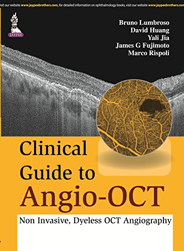 Beispielbild fr Clinical Guide to Angio-OCT. zum Verkauf von Research Ink