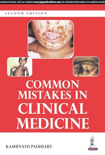 Stock image for Common Mistakes in Clinical Medicine for sale by Books Puddle