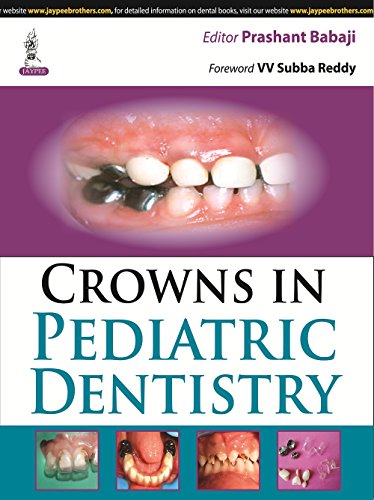 9789351524397: Crowns in Pediatric Dentistry