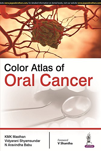 9789351524410: Color Atlas of Oral Cancer