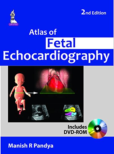 9789351524762: Atlas of Fetal Echocardiography