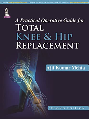 9789351524823: A Practical Operative Guide for Total Knee and Hip Replacement