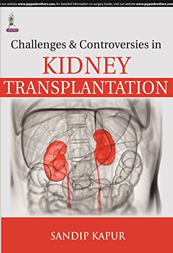 9789351525257: Challenges and Controversies in Kidney Transplantation
