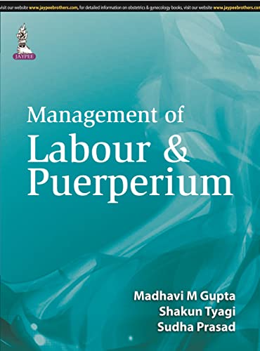 Stock image for Management of Labour and Puerperium for sale by Ria Christie Collections