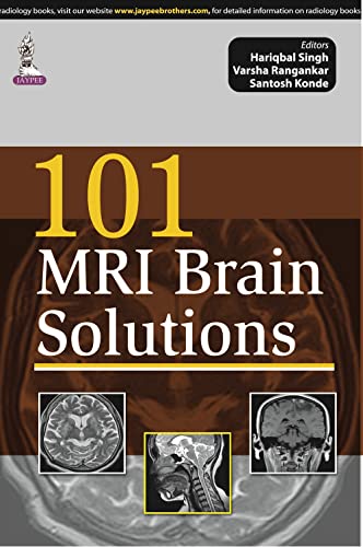 Stock image for 101 MRI Brain Solutions for sale by Books Puddle