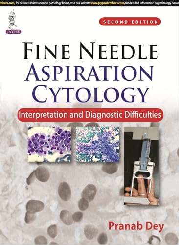 Imagen de archivo de FINE NEEDLE ASPIRATION CYTOLOGY INTERPRETATION AND DIAGNOSTIC DIFFICULTIES a la venta por Basi6 International