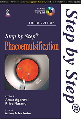 Beispielbild fr Step by Step Phacoemulsification zum Verkauf von WorldofBooks