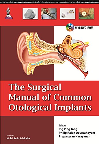 9789351528586: The Surgical Manual of Common Otological Implants