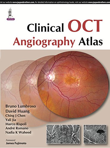 Stock image for Clinical OCT Angiography Atlas for sale by Books Puddle