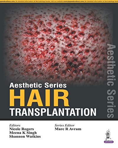 Stock image for Aesthetic Series - Hair Transplantation for sale by TextbookRush