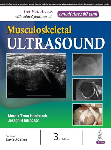 Stock image for MUSCULOSKELETAL ULTRASOUND for sale by Basi6 International