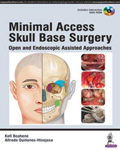 Imagen de archivo de Minimal Acess Skull Surgery a la venta por Books Puddle