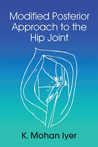 Stock image for Modified Posterior Approach to the Hip Joint for sale by Revaluation Books