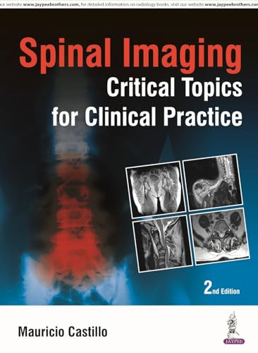 Stock image for Spinal Imaging for sale by Books Puddle