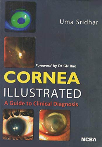 Stock image for CORNEA ILLUSTRATED: A GUIDE TO CLINICAL DIAGNOSIS for sale by Shalimar Books