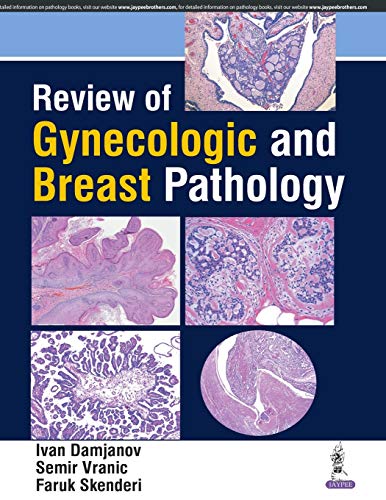 Stock image for Review of Gynecologic and Breast Pathology for sale by HPB-Red