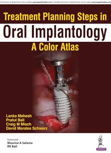 Stock image for Treatment Planning Steps in Oral Implantology: A Color Atlas for sale by Books From California