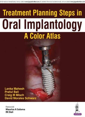 9789352700592: Treatment Planning Steps in Oral Implantology: A Color Atlas