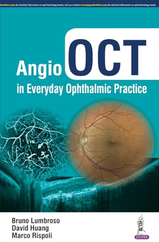 Stock image for Angio OCT in Everyday Ophthalmic Practice for sale by HPB-Red