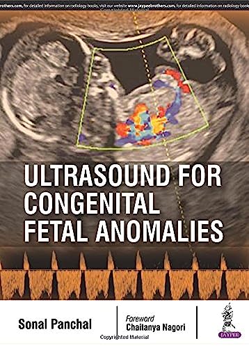 Beispielbild fr Ultrasound for Congenital Fetal Anomalies zum Verkauf von GF Books, Inc.