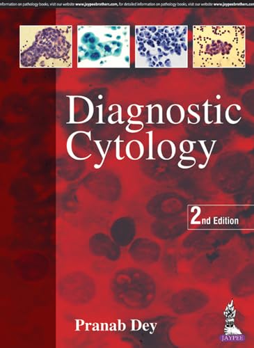 Beispielbild fr Dey, P: Diagnostic Cytology zum Verkauf von getbooks GmbH