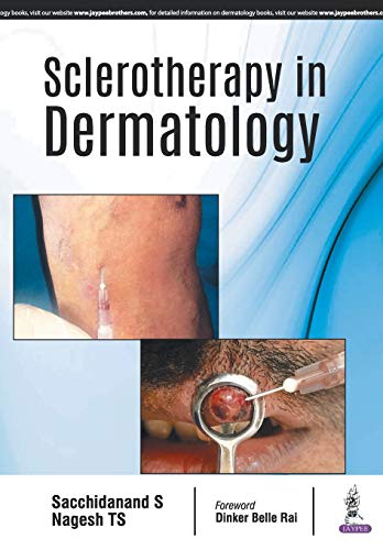 Beispielbild fr Sclerotherapy In Dermatology zum Verkauf von Buchpark