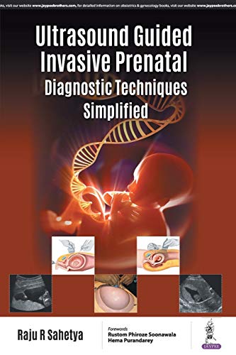 Stock image for Ultrasound Guided Invasive Prenatal Diagnostic Techniques Simplified for sale by Chiron Media