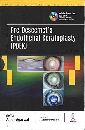 Stock image for PRE-DESCEMET'S ENDOTHELIAL KERATOPLASTY(PDEK) for sale by Basi6 International