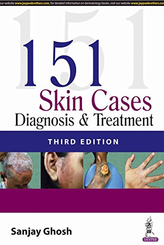 Stock image for 151 Skin Cases: Diagnosis and Treatment for sale by Mispah books