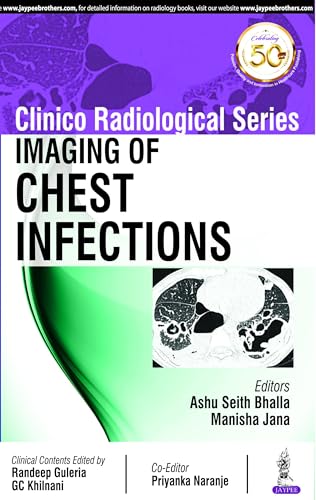 Stock image for Clinico Radiological Series Imaging Of Chest Infections for sale by Books in my Basket