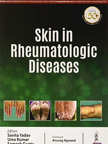 Stock image for Skin in Rheumatologic Diseases for sale by GreatBookPrices