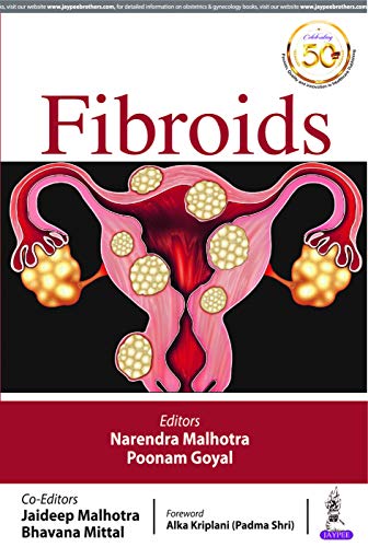 Beispielbild fr Fibroids zum Verkauf von Books Puddle