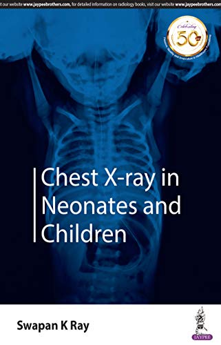 Stock image for Chest X-ray in Neonates and Children for sale by Books Puddle