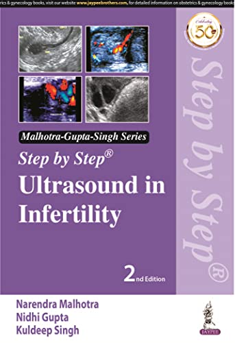 Imagen de archivo de Step by step Ultrasound in Infertility a la venta por Books Puddle