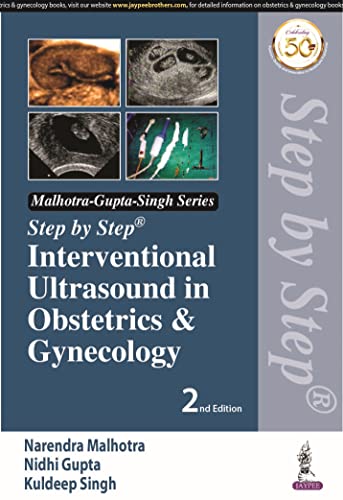 Stock image for Step by Step Interventional Ultrasound in Obstetrics and Gynecology for sale by Books Puddle