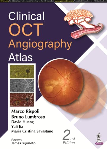 Stock image for Clinical Oct Angiography Atlas [Hardcover] Rispoli, Marco; Lumbroso, Bruno; Huang, David; Jia, Yali and Savastano, Cristina for sale by Brook Bookstore