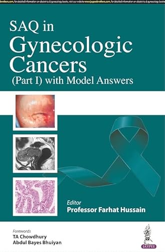 Stock image for SAQ in Gynecological Cancers (Part 1) With Model Answers for sale by Vedams eBooks (P) Ltd