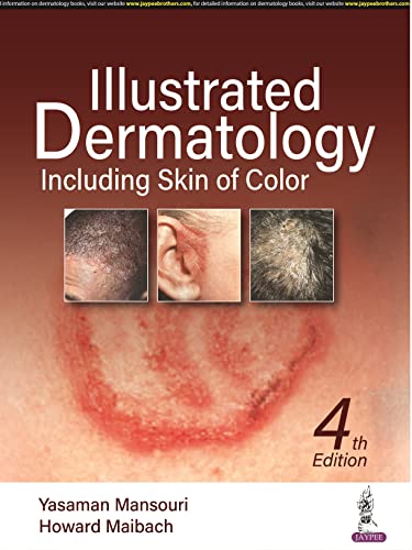 Beispielbild fr Illustrated Dermatology: Including Skin of Colour zum Verkauf von Monster Bookshop