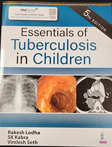 Stock image for Essentials of Tuberculosis in Children for sale by Books Puddle